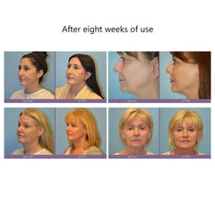 The Best Facial Microcurrent Roller Massager: Face Lifting And Tightening Device